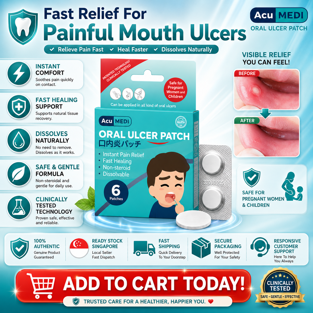 AcuMEDI Oral Ulcer Patch 6pcs | Instant Relief | Non-Steroid | Safe for Kids