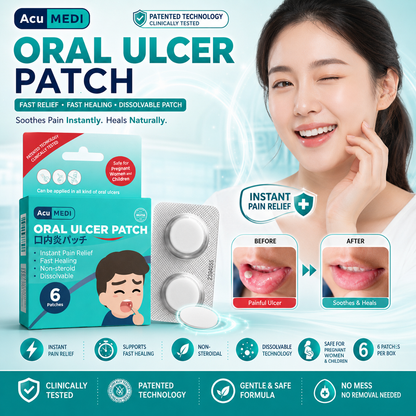 AcuMEDI Oral Ulcer Patch 6pcs | Instant Relief | Non-Steroid | Safe for Kids