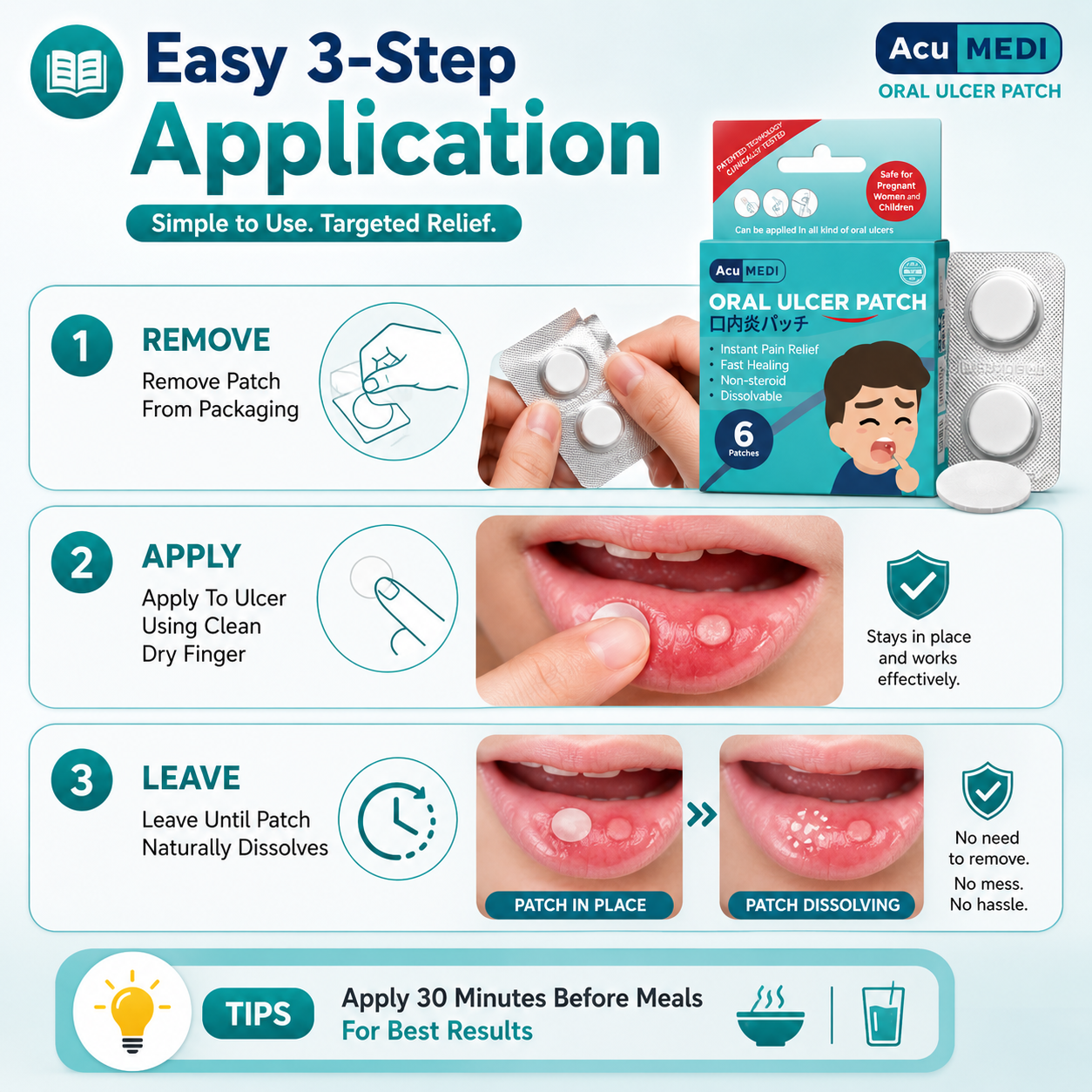 AcuMEDI Oral Ulcer Patch 6pcs | Instant Relief | Non-Steroid | Safe for Kids