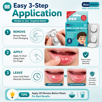 AcuMEDI Oral Ulcer Patch 6pcs | Instant Relief | Non-Steroid | Safe for Kids